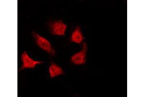 ABIN6267224 staining HeLa by IF/ICC. (CHEK1 anticorps  (pSer317))