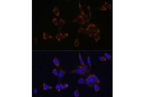 Immunofluorescence analysis of NIH/3T3 cells using Perforin antibody (ABIN3020641, ABIN3020642, ABIN3020643 and ABIN6213612) at dilution of 1:100.