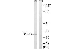 Western Blotting (WB) image for anti-Complement Component 1, Q Subcomponent, C Chain (C1QC) (Internal Region) antibody (ABIN1851148) (C1QC anticorps  (Internal Region))