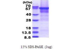 SDS-PAGE (SDS) image for Cytoplasmic Polyadenylation Element Binding Protein 1 (CPEB1) (AA 1-561) protein (His tag) (ABIN5853676) (CPEB1 Protein (AA 1-561) (His tag))
