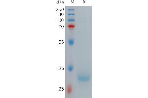 Human HAMP(65-84) Protein, hFc Tag on SDS-PAGE under reducing condition.