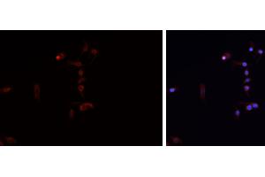 ABIN6276729 staining HEPG2 cells by IF/ICC. (Tryptophan Hydroxylase 1 anticorps  (Internal Region))