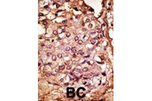 Immunohistochemistry (IHC) image for anti-Chemokine Binding Protein 2 (CCBP2) antibody (ABIN3001323)