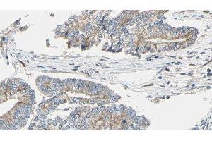 ABIN6275020 at 1/100 staining Human prostate tissue by IHC-P. (CLASP1 anticorps  (Internal Region))