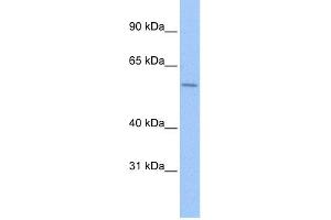 WB Suggested Anti-ZNF596 Antibody Titration:  0.