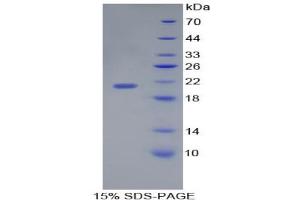 SDS-PAGE analysis of Human Interleukin 17C Protein. (IL17C Protéine)