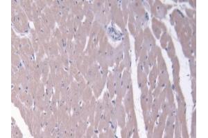 Detection of ABCC6 in Rat Heart Tissue using Polyclonal Antibody to ATP Binding Cassette Transporter C6 (ABCC6)