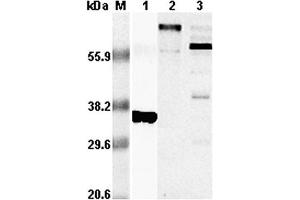 Western blot analysis using anti-RANKL (human), pAb  at 1:5,000 dilution. (RANKL anticorps)