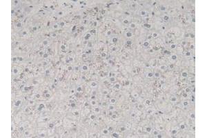 Figure. (TGFB3 anticorps  (AA 24-300))