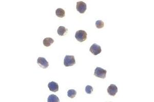 Immunocytochemistry of Chk2 in Jurkat cells with AP30226PU-N Chk2 antibody at 1 μg/ml.