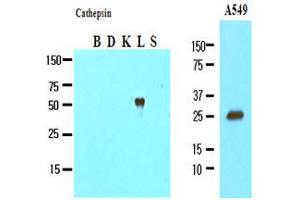 Western Blotting (WB) image for anti-Cathepsin L1 (CTSL1) (AA 114-333) antibody (ABIN317508) (Cathepsin L anticorps  (AA 114-333))