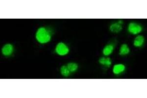 Image no. 12 for anti-Myc Proto-Oncogene protein (MYC) antibody (ABIN1497012) (c-MYC anticorps)