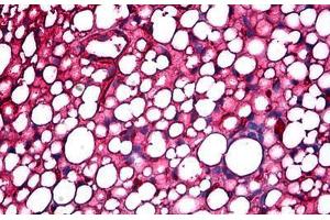 Mouse Kidney, Adipose: Formalin-Fixed, Paraffin-Embedded (FFPE)