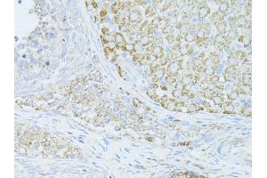Immunohistochemistry of paraffin-embedded mouse ovary using OCLN antibody (ABIN6003517) at dilution of 1/100 (40x lens).