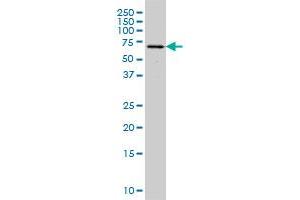 FGR monoclonal antibody (M01), clone 3G10 Western Blot analysis of FGR expression in HeLa .
