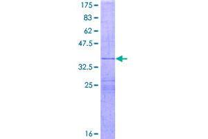 Image no. 1 for Interleukin 26 (IL26) (AA 74-171) protein (GST tag) (ABIN1307799)