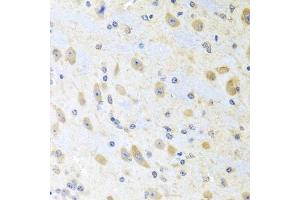 Immunohistochemistry of paraffin-embedded mouse brain using MLN antibody (ABIN6128307, ABIN6143890, ABIN6143891 and ABIN6222013) at dilution of 1:100 (40x lens). (Motilin anticorps  (AA 26-115))