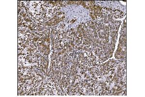 IHC analysis of LRP1B using anti-LRP1B antibody (ABIN7601521). (LRP1B anticorps  (AA 3704-4547))