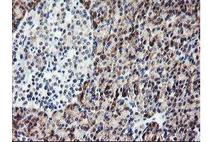 Immunohistochemistry (IHC) image for anti-Platelet/endothelial Cell Adhesion Molecule (PECAM1) antibody (ABIN1497243) (CD31 anticorps)