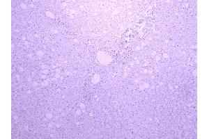 ABIN185606 Negative Control showing staining of paraffin embedded Human Liver, with no primary antibody.