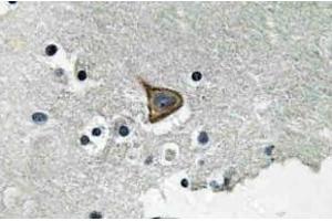 Immunohistochemistry (IHC) analyzes of p-Connexin 43 antibody in paraffin-embedded human brain tissue. (Connexin 43/GJA1 anticorps  (pSer367))