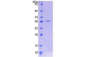 SDS-PAGE (SDS) image for Caspase 8 (CASP8) (AA 8-197) protein (His tag) (ABIN6236699) (Caspase 8 Protein (CASP8) (AA 8-197) (His tag))