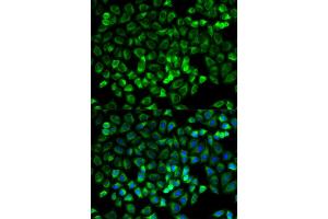 Immunofluorescence analysis of HeLa cells using TPSAB1 antibody. (TPSAB1 anticorps)