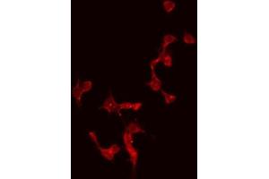 ABIN6274996 staining Hela by IF/ICC. (CBLN4 anticorps  (Internal Region))