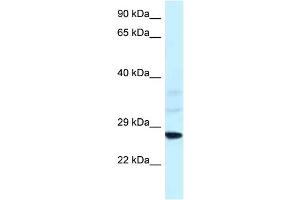 WB Suggested Anti-Snf8 Antibody   Titration: 1. (SNF8 anticorps  (N-Term))