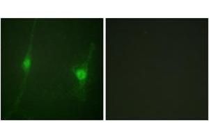 Immunofluorescence (IF) image for anti-serine/threonine Kinase 11 (STK11) (AA 384-433) antibody (ABIN2888735) (LKB1 anticorps  (AA 384-433))