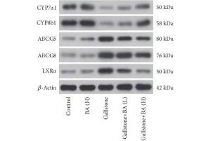 Western blot was used to measure the protein levels of CYP7a1, CYP8b1, adenosine triphosphate binding cassette (ABC)G5, ABCG8 (ABIN3022643), and LXRα in the liver of mice that received a lithogenic diet or Baicalin administration.