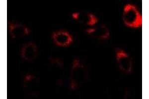 Immunofluorescent analysis of CCT3 staining in U2OS cells. (CCT3 anticorps)