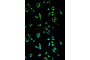 Immunofluorescence analysis of MCF7 cell using APOBEC3G antibody. (APOBEC3G anticorps  (AA 60-330))