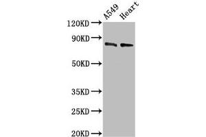 Western Blot Positive WB detected in: A549 whole cell lysate, Mouse heart tissue All lanes: DNM1L antibody at 0. (Dynamin 1-Like anticorps  (AA 496-710))