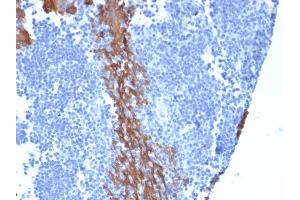 Formalin-fixed, paraffin-embedded human Tonsil stained with Cytokeratin 13 Mouse Monoclonal Antibody (KRT13/2213).