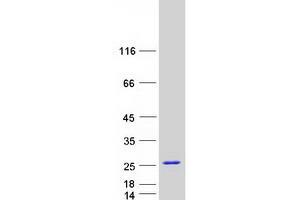Validation with Western Blot