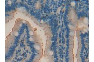 DAB staining on IHC-P; Samples: Mouse Intestine Tissue (ACP5 anticorps  (AA 28-286))