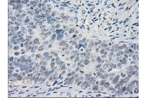 Immunohistochemical staining of paraffin-embedded Ovary tissue using anti-PORmouse monoclonal antibody. (POR anticorps)