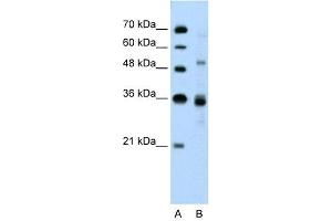 WB Suggested Anti-TNRC4 Antibody Titration: 0. (CELF3 anticorps  (N-Term))