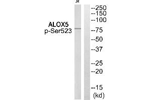 Western blot analysis of extracts from Jurkat cells, using ALOX5 (Phospho-Ser523) Antibody. (ALOX5 anticorps  (pSer523))
