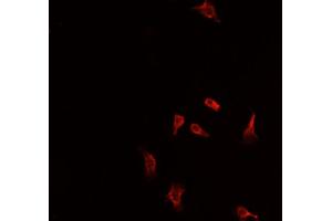 ABIN6266924 staining  Hep G2 cells by IF/ICC.