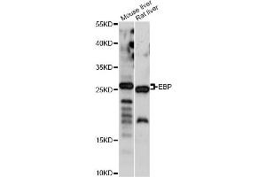 Western blot analysis of extracts of various cell lines, using EBP antibody. (EBP anticorps)