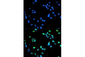 Immunofluorescence analysis of HeLa cell using IRF5 antibody. (IRF5 anticorps)