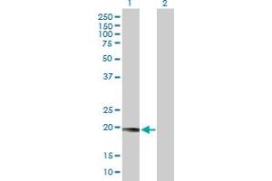 Western Blot analysis of LYZL1 expression in transfected 293T cell line by LYZL1 MaxPab polyclonal antibody. (Lysozyme-Like 1 anticorps  (AA 1-194))