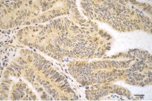 anti-Gasdermin D (GSDMD) antibody