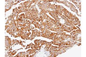 IHC-P Image Immunohistochemical analysis of paraffin-embedded OVCA xenograft, using ARPC2, antibody at 1:100 dilution.