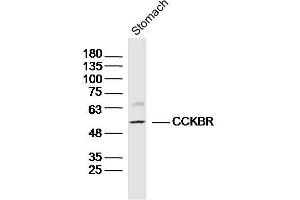 Mouse Stomach lysates probed with CCKBR Polyclonal Antibody, Unconjugated  at 1:300 dilution and 4˚C overnight incubation.