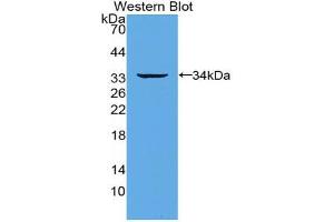 Western blot analysis of the recombinant protein. (TNFRSF11A anticorps  (AA 330-615))