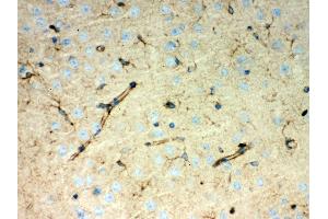 anti-Peroxiredoxin 1 (PRDX1) (AA 100-128), (Middle Region) antibody