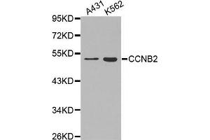 Western blot analysis of extracts of various cell lines, using CCNB2 antibody.